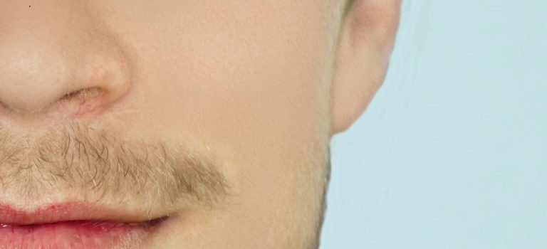 Triamcinolone Acetonide-foglio illustrativo