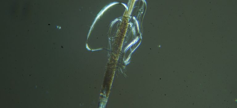 Microscopia in luce polarizzata, squalene e acido lattico