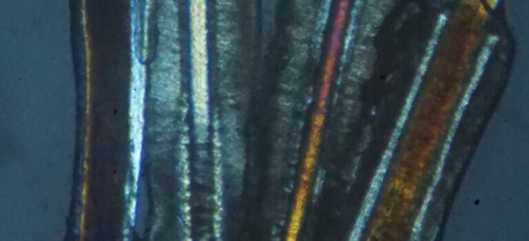 Microscopia in Luce Polarizzata: “l’importanza dei numeri”